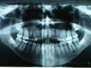 Dental x-ray.